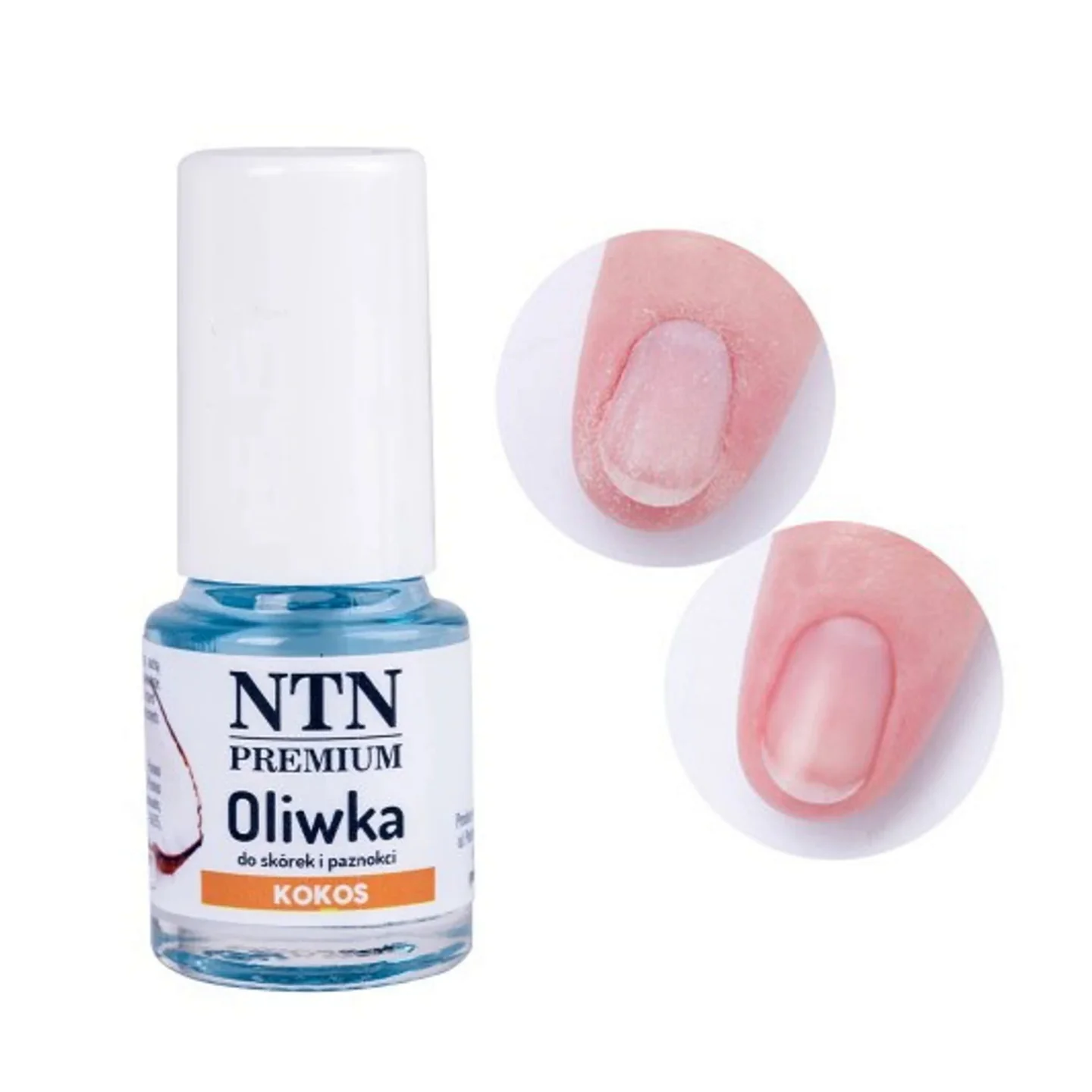 Aceite Cutículas Aroma Coco - NTN Premium - 5ml - Imagen 2